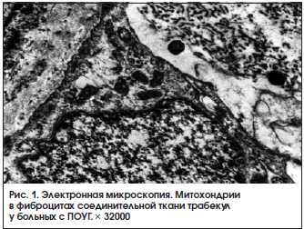 Рис. 1. Электронная микроскопия. Митохондрии в фиброцитах соединительной ткани трабекул у больных с ПОУГ. × 32000