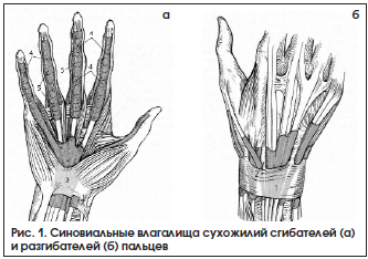 Рис. 1. Синовиальные влагалища сухожилий сгибателей (а) и разгибателей (б) пальцев