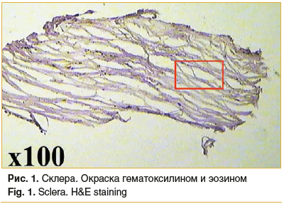 Рис. 1. Склера. Окраска гематоксилином и эозином Fig. 1. Sclera. H&E staining